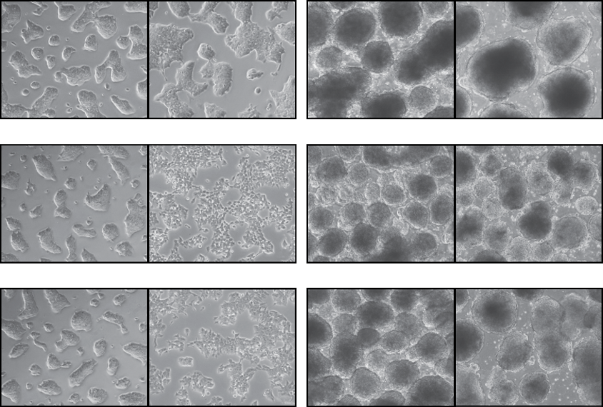 Research image showing suppressed neuronal differentiation in cells lacking the gene ZFP462.