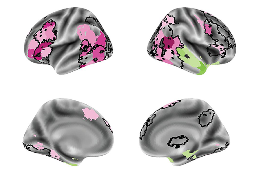 Brain scans displaying activity in areas linked with social behavior.