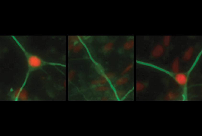 Research image of cell bodies of rett-like neurons, some of which were treated with epigenome editors.