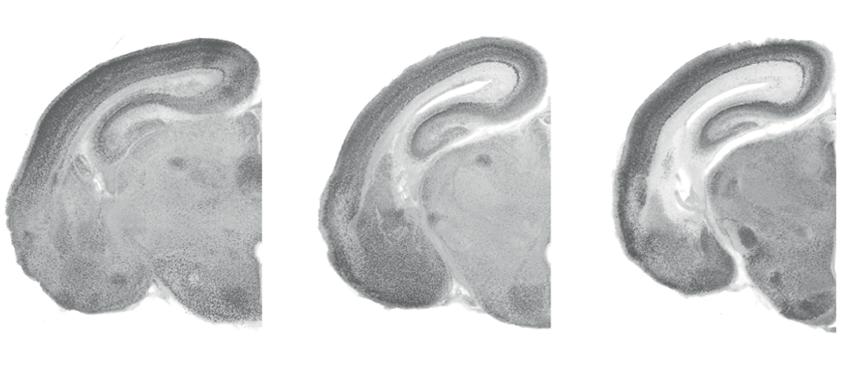 Mouse brain slices displaying thinner cortices in mice with MYT1L variants.