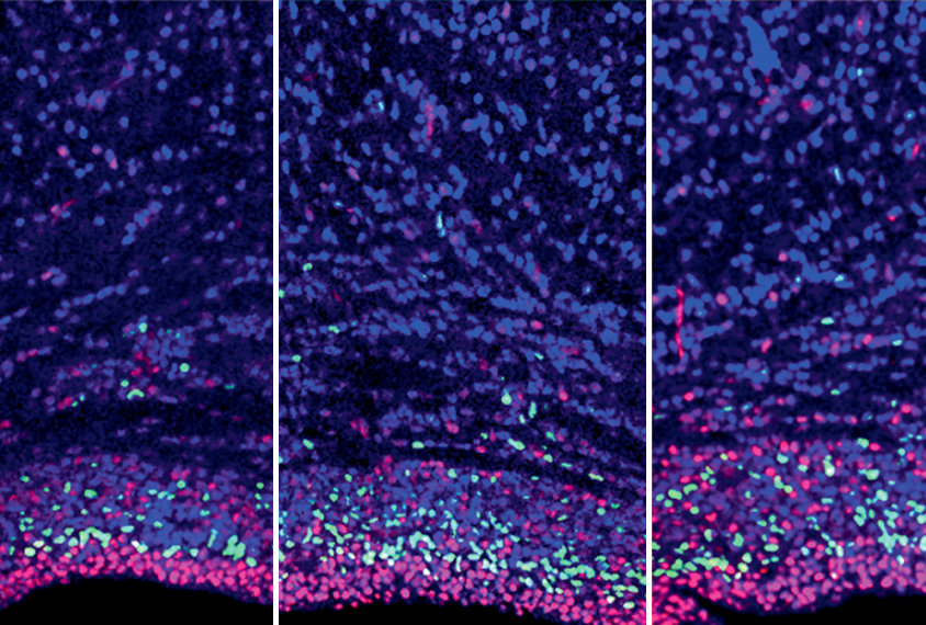 Research image shows elevated expression of certain genes, shown in pink and green, along with expected gene expression, shown in blue.