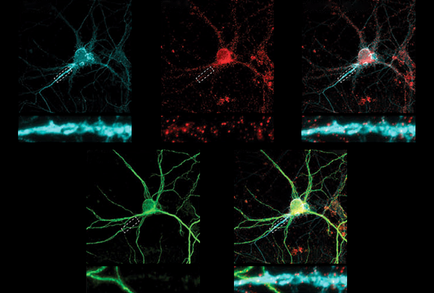 Research image showing the presence of several proteins in neurons.