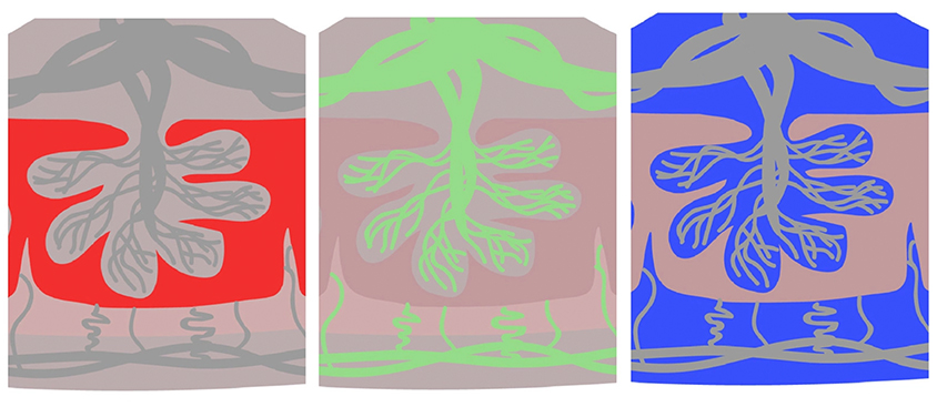 Three images of placentas