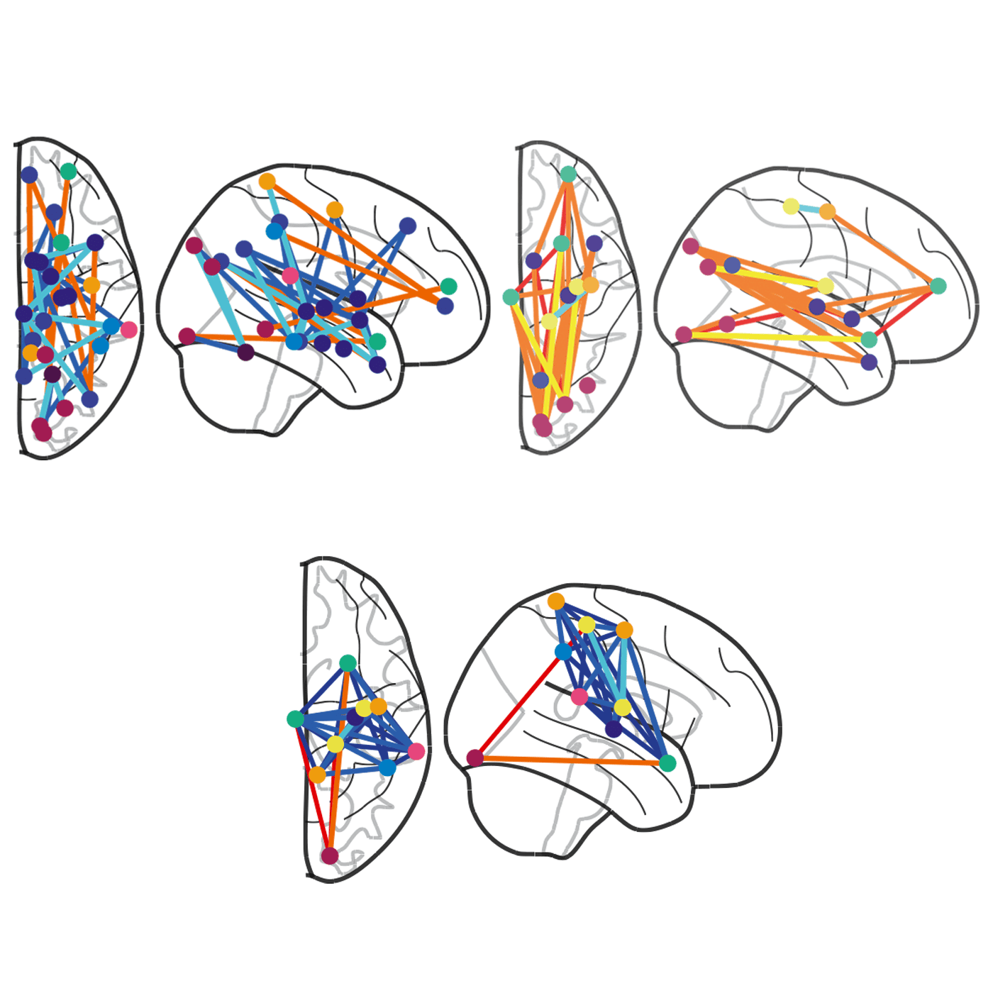 Brain connectivity, behavior flag four autism subtypes episode artwork