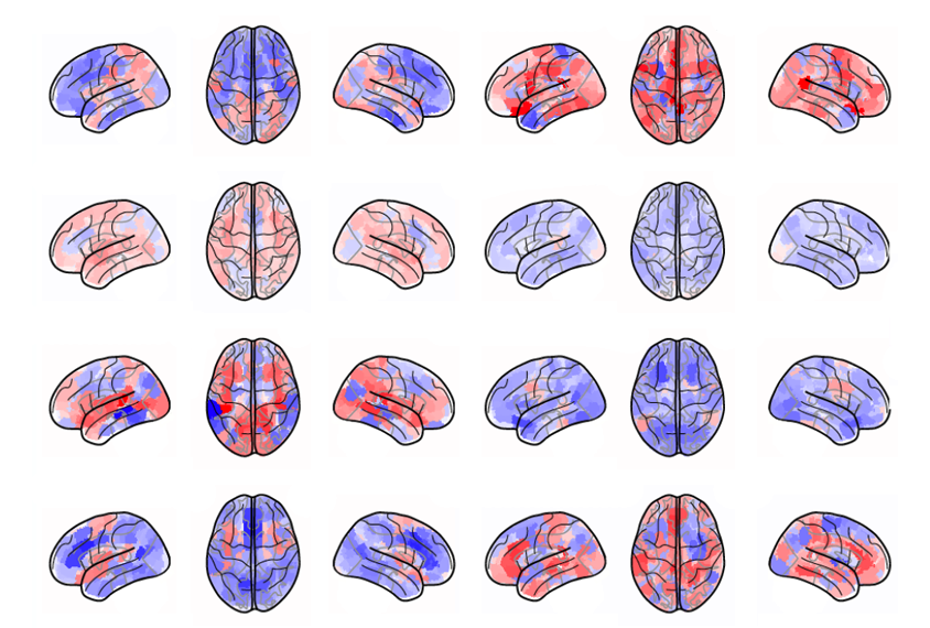 Research diagram of brains viewed from overhead and in profile.