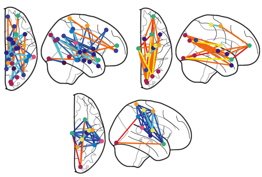 Research illustration of three brain diagrams.