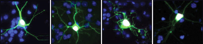 Research image of neurons lacking NPAS4.