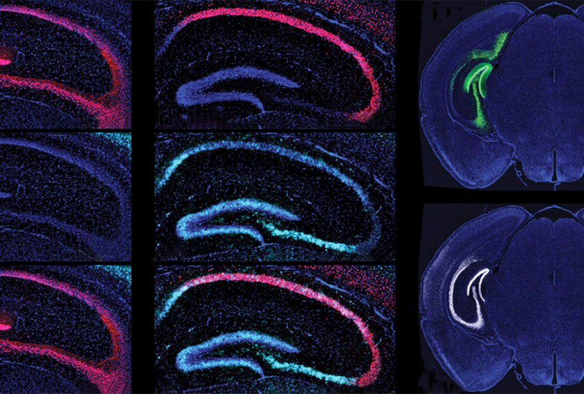 A grid of brain scans.