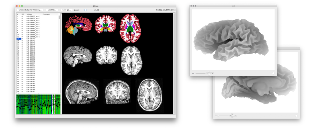 Screencap of a computer displaying multiple brain scans.