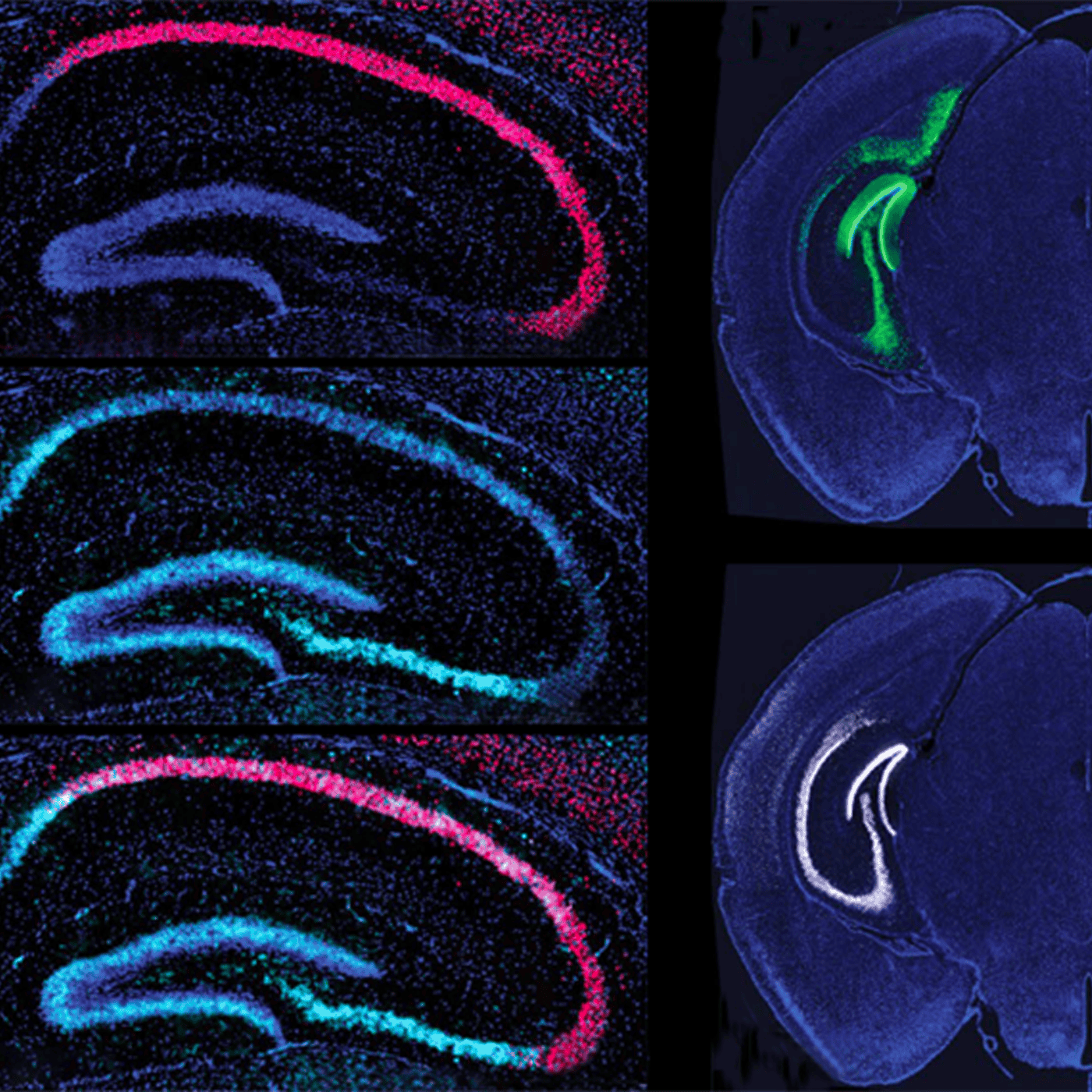 To repair DNA, neurons harness autism-linked proteins episode artwork
