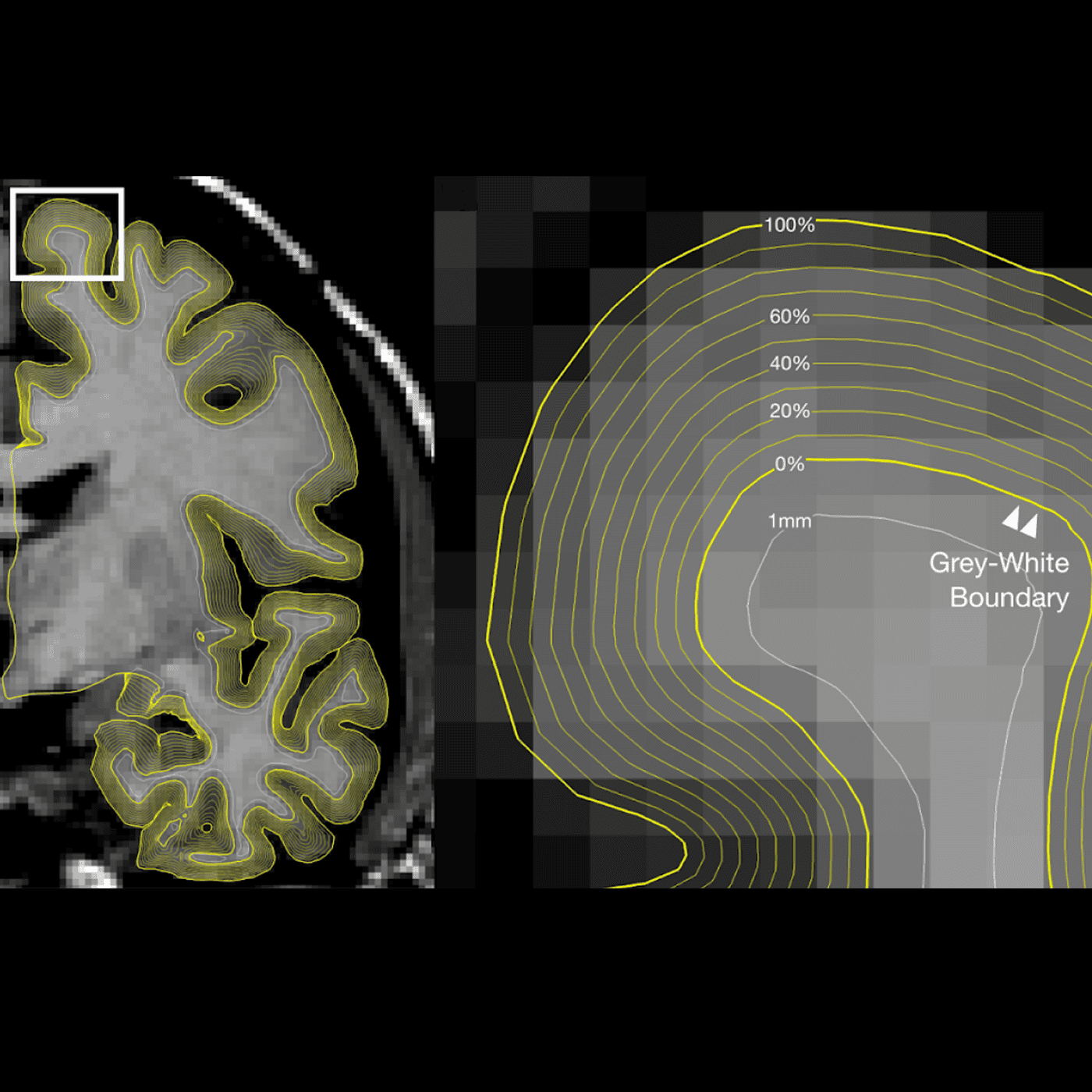 Brain imaging do-over offers clues to field's replication problem episode artwork