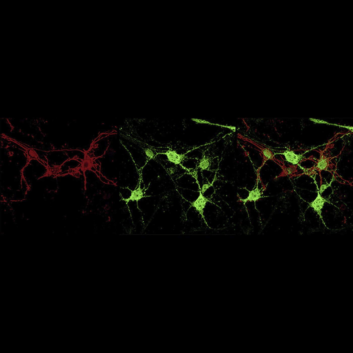 'Splice-switching' strategy boosts SYNGAP1 expression episode artwork