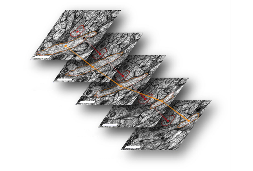 Research image displaying individual neurons being traced through multiple brain slices.