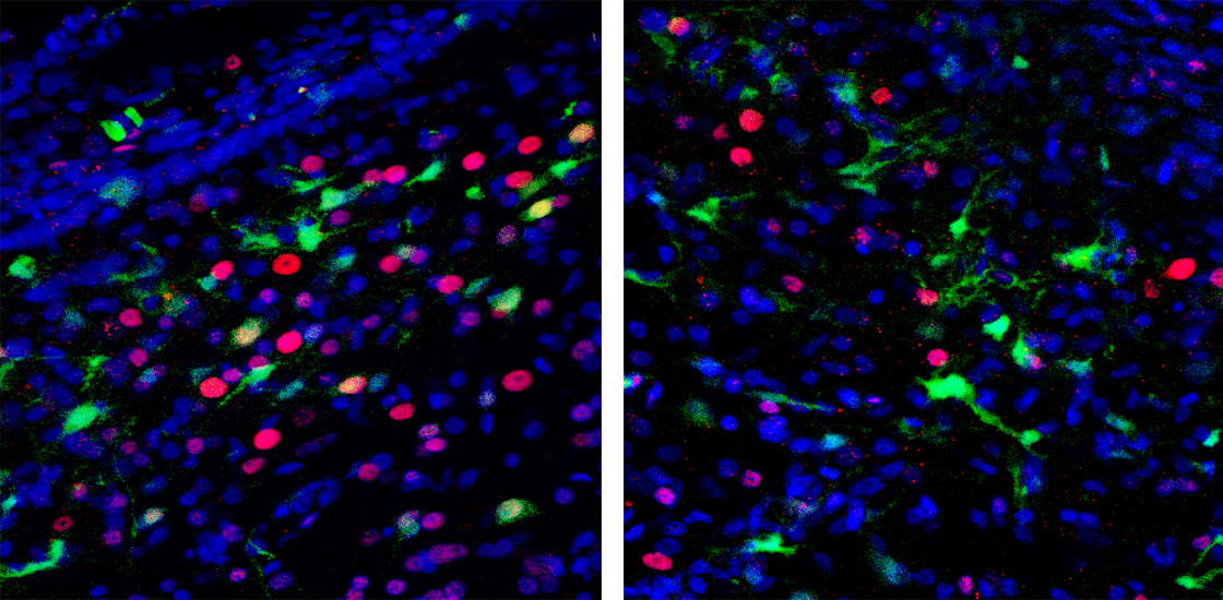 Research image showing FOXP1 gene expression in female zebra finch brains.