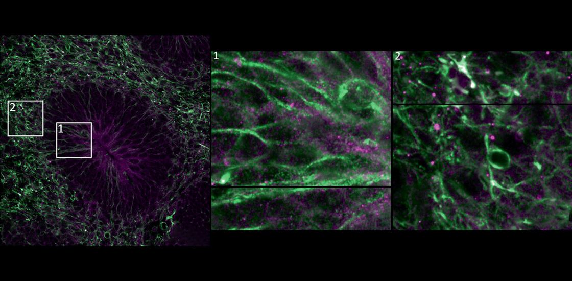 Research image of radial glial cells in a human brain organoid.