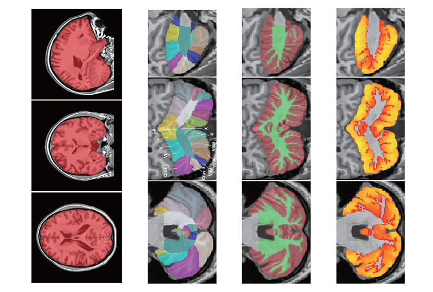 A composite of cerebellum images