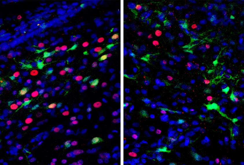 Research image showing FOXP1 gene expression in female zebra finch brains.