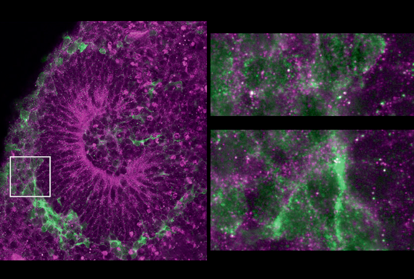 Research image of intermediate progenitor cells in a human brain organoid.