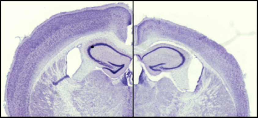 Research image of two mouse brain slices; the one on the right is smaller and has a thinner cortex than the control on the left.