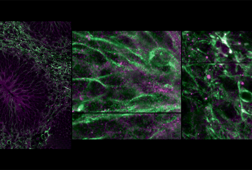 Research image of radial glial cells in a human brain organoid.