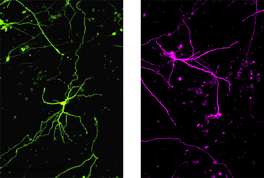 Two images of neurons. The neuron image on the left is green, and the neuron image on the right is pink.
