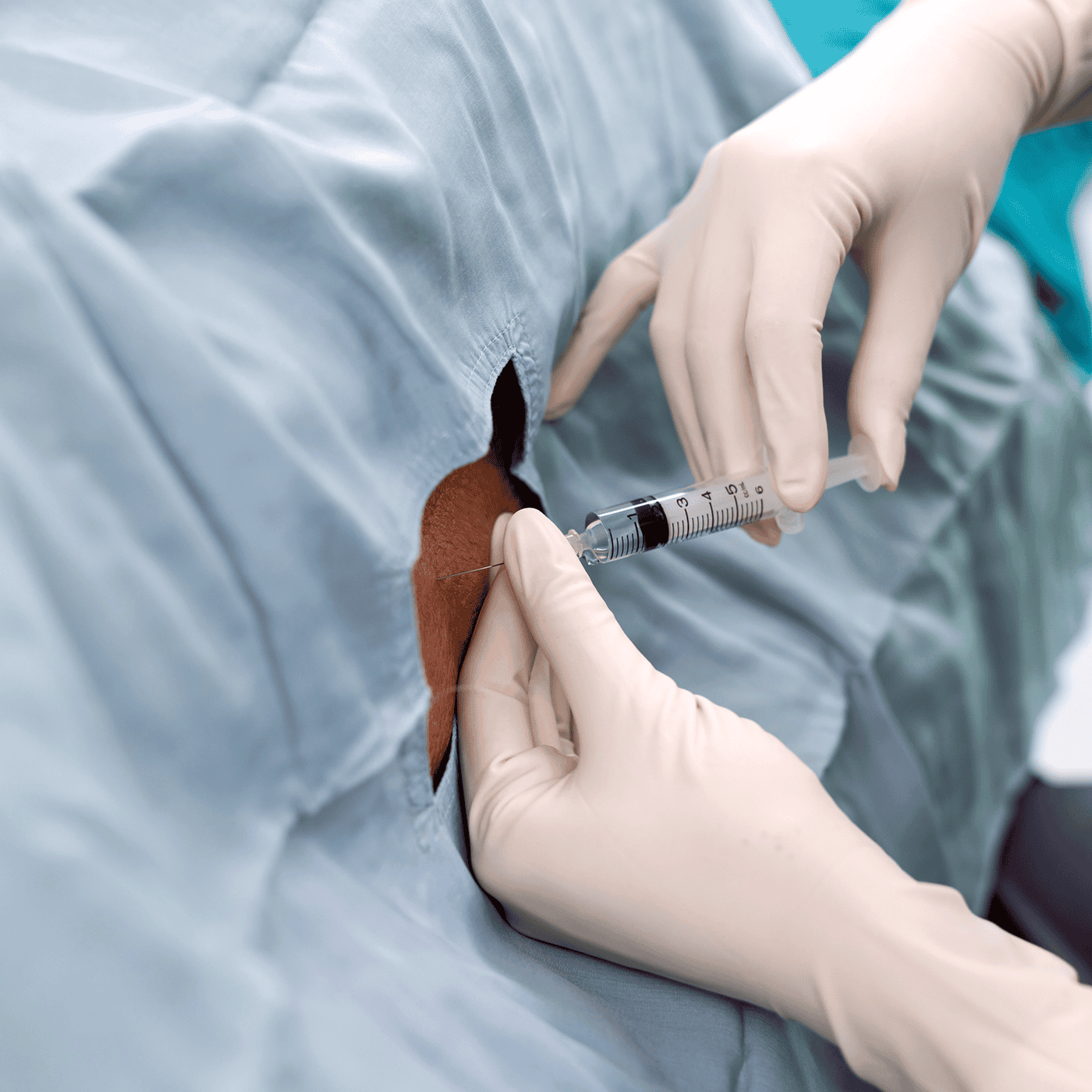 A questionable study linked epidurals to autism. Then what? episode artwork