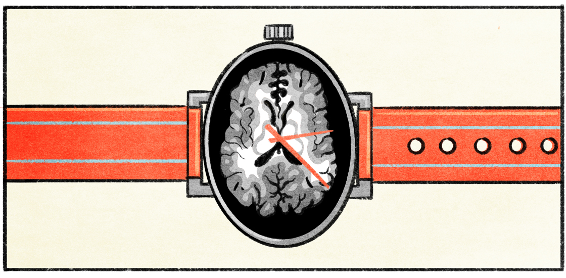 Illustration of a watch with the face taken up by an MRI scan of a brain.