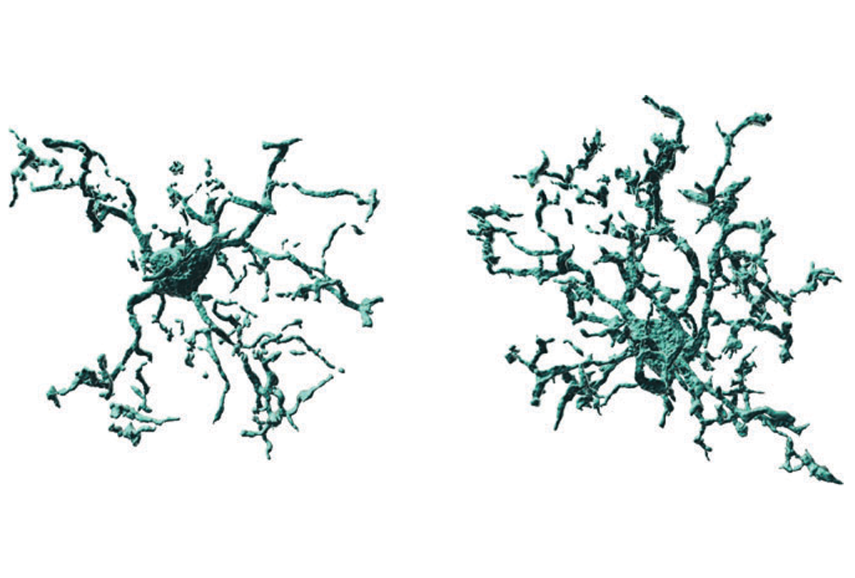 Microglial cells taken from mice.