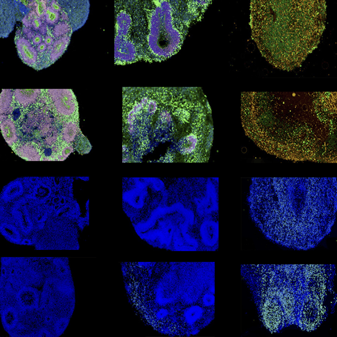 Genetic background sways effects of autism-linked mutation episode artwork
