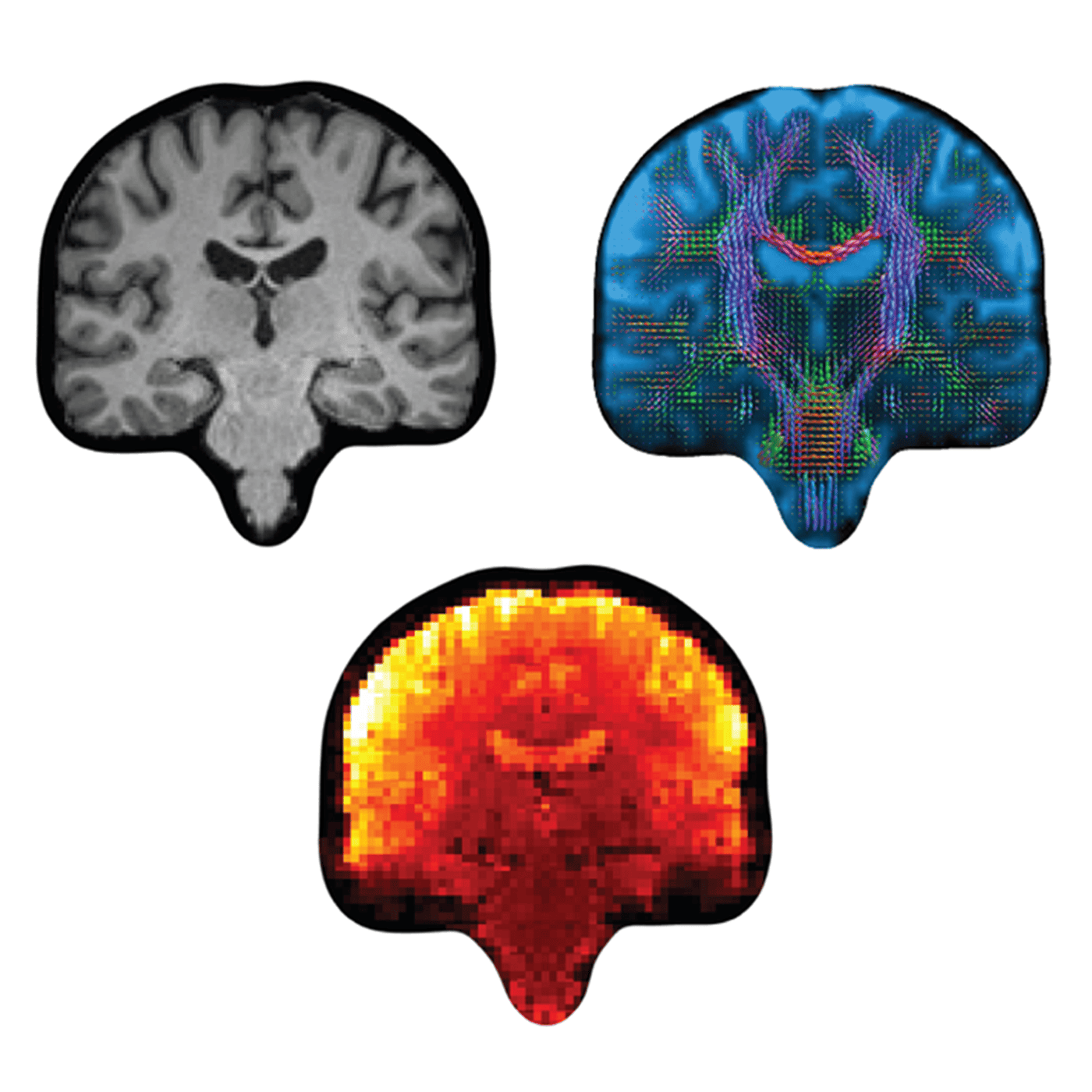 Dataset maps connectivity in 40,000 brains episode artwork
