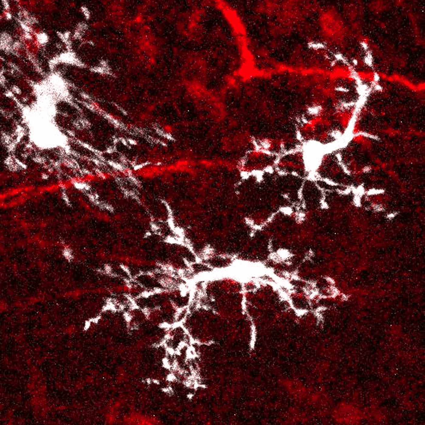 Grafted organoids reveal how microglia adapt to shifting brain environments episode artwork