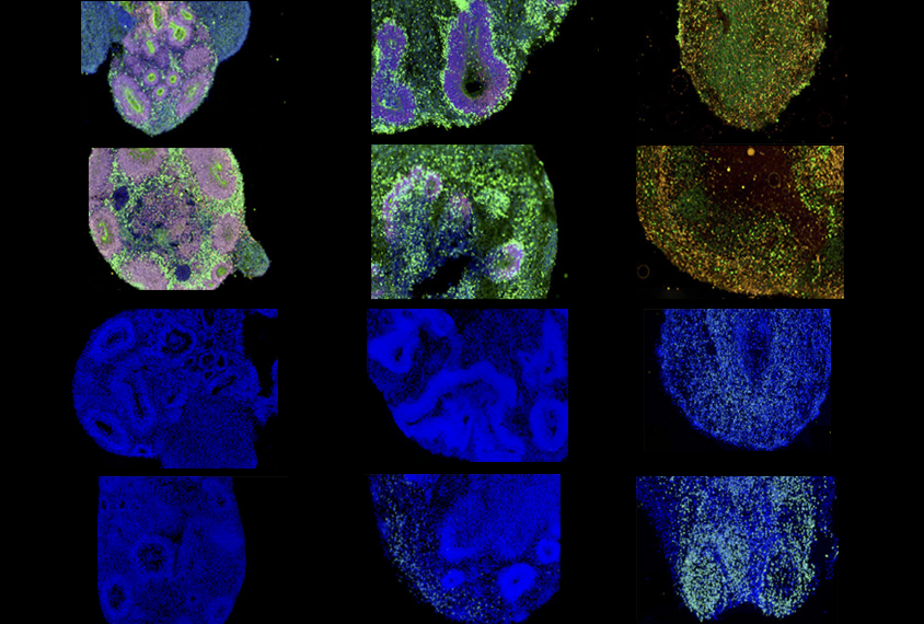 Composite research image of organoids at several stages of development.