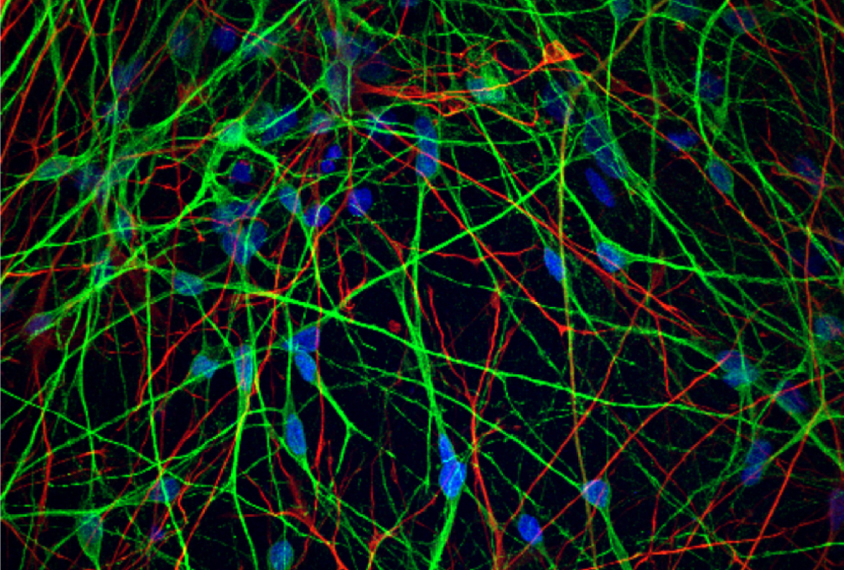 Research image of neurons and astrocytes.