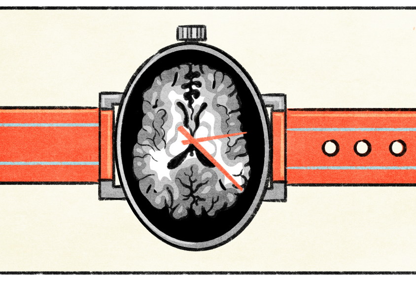 Illustration of a watch with the face taken up by an MRI scan of a brain.