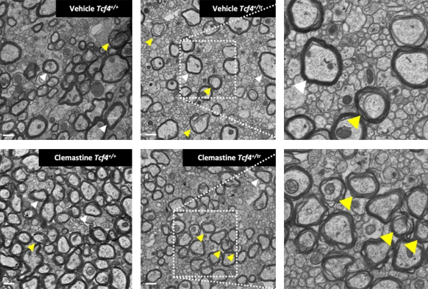 A composite of six images showing increased myelination in axons treated with clemastine