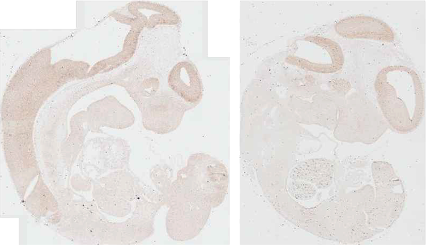 Research image of a developing mouse embryo.