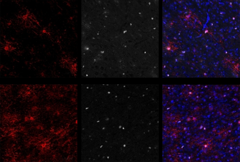 Research image of oligodendrocytes in mice treated with clemastine compared to untreated mice.