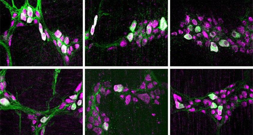 a composite of six images showing differences in protein expression in different parts of the intestinal tract