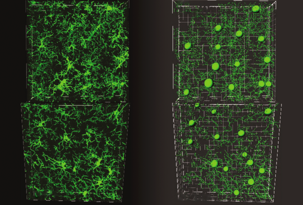Research image comparing microglia with serotonin receptors to those without.