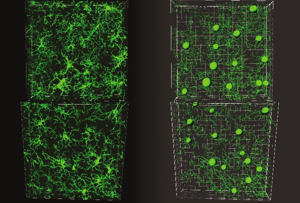Research image comparing microglia with serotonin receptors to those without.