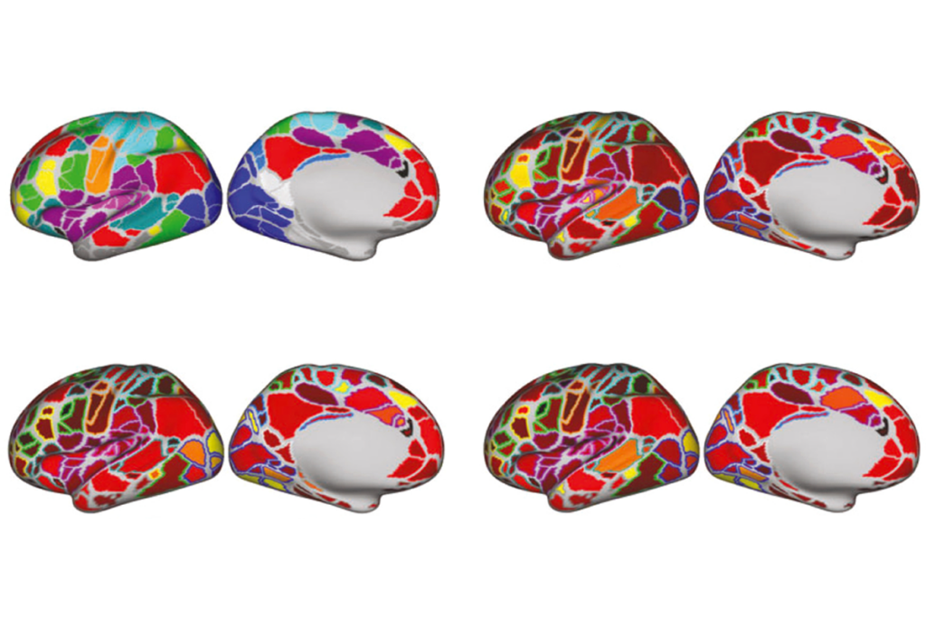 Research image of brain scans showing connections in the brain in different colors.