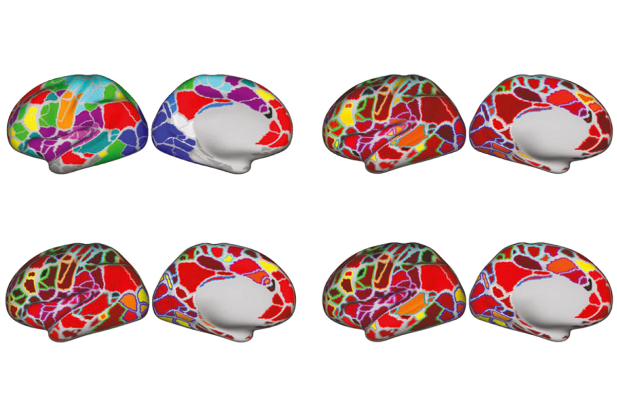 Research image of brain scans showing connections in the brain in different colors.