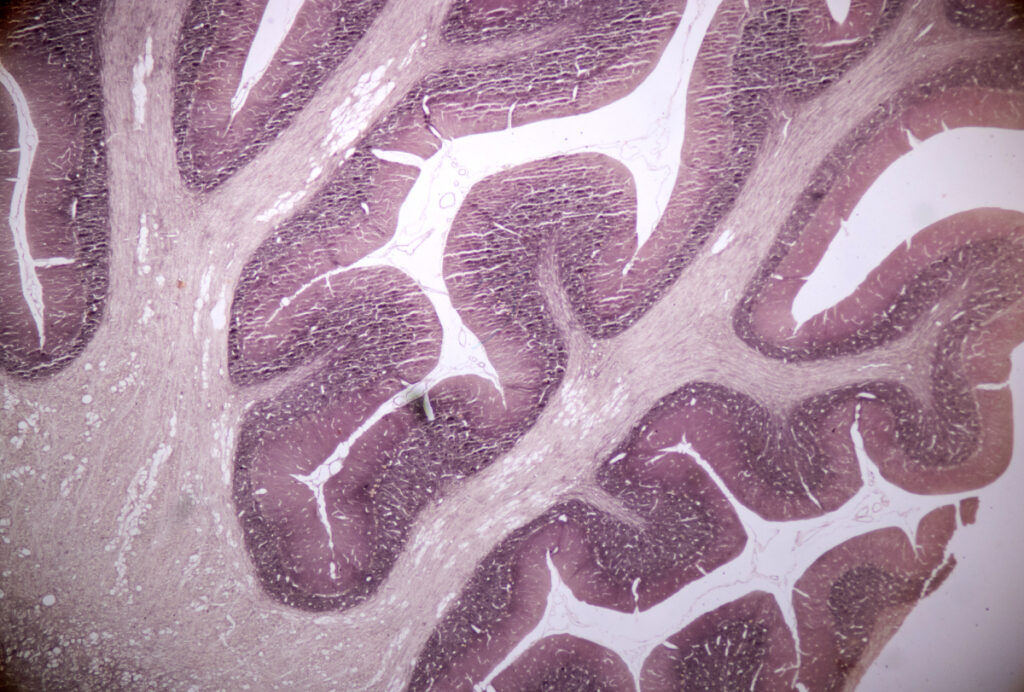 A brain slice under a microscope.