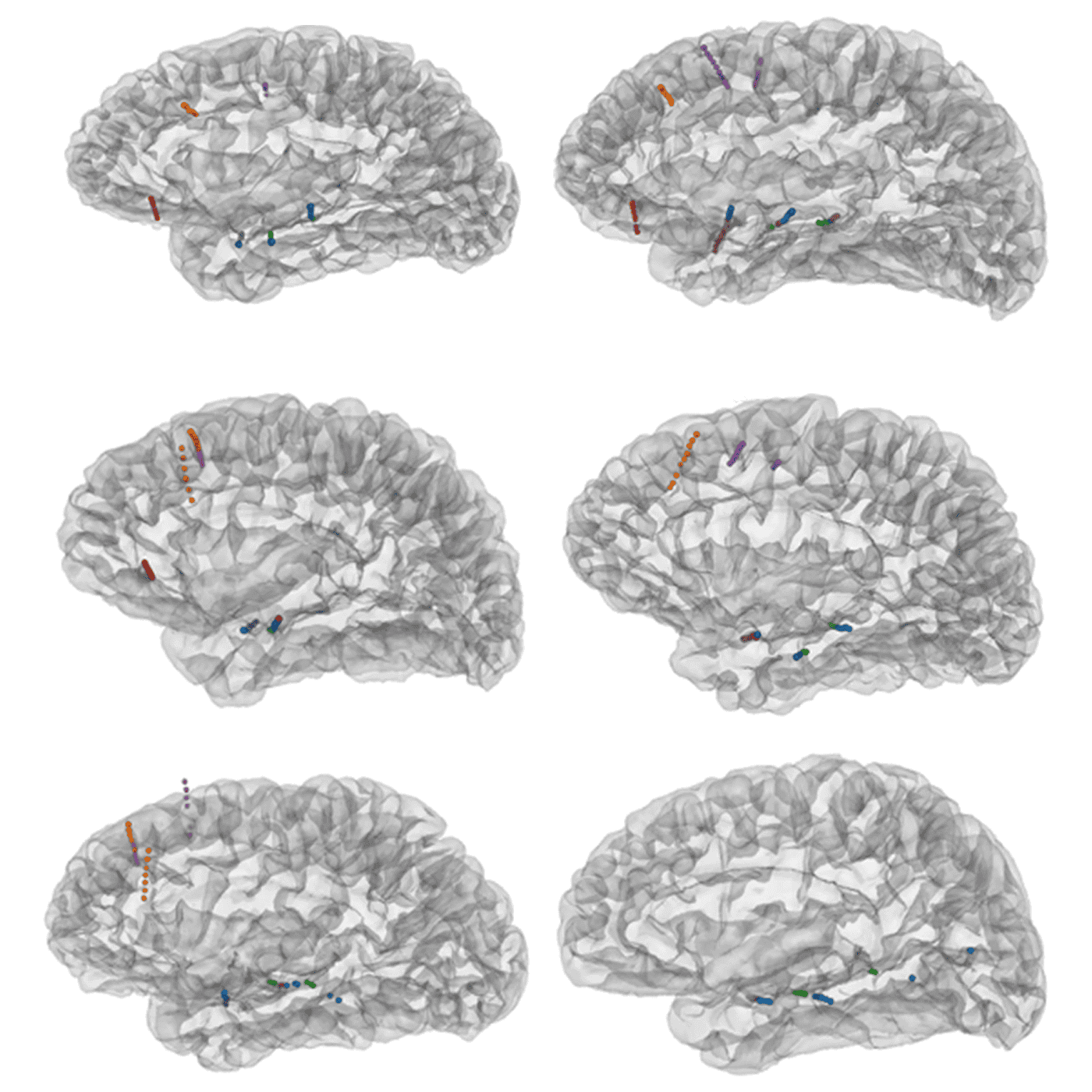 AI model helps decode brain activity underlying conversation episode artwork