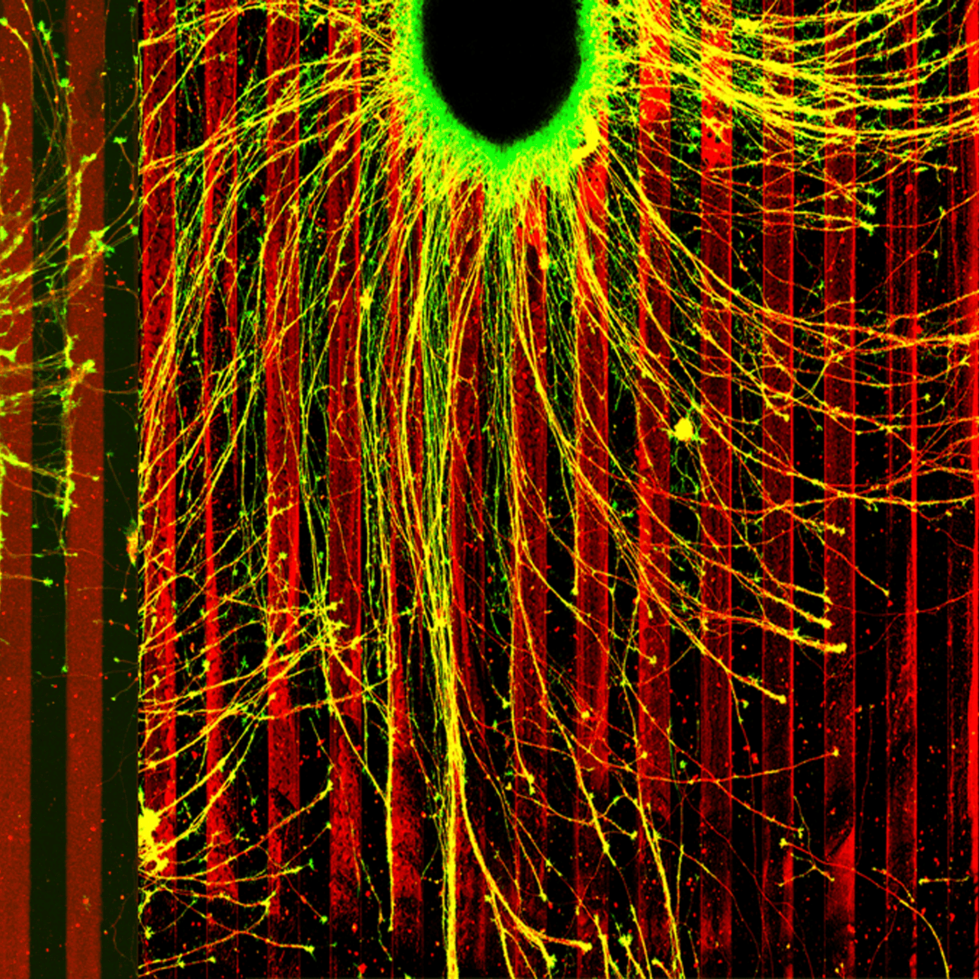 Autism's ties to the cell skeleton episode artwork