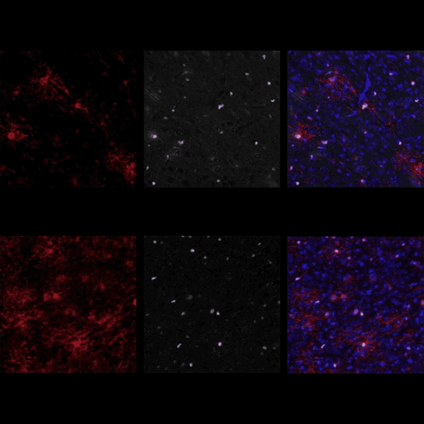 Antihistamine aids myelination in Pitt-Hopkins mice episode artwork