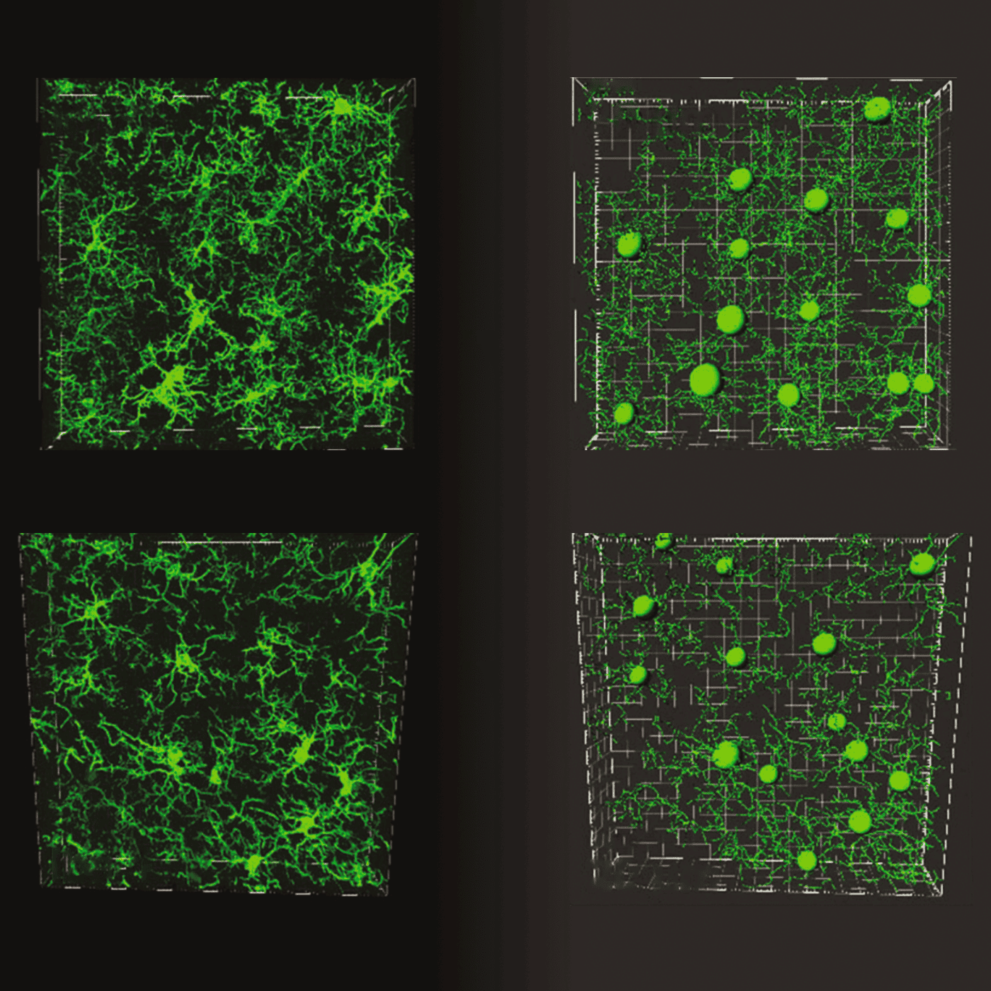 Serotonin powers pruning of developing brain circuits in mice episode artwork