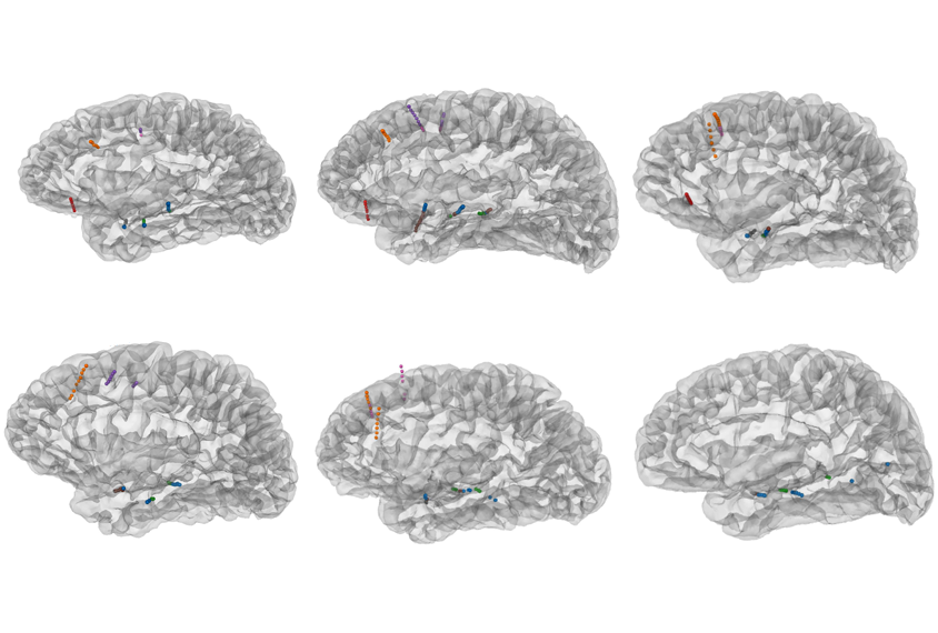 Research image of brain activity during conversation.