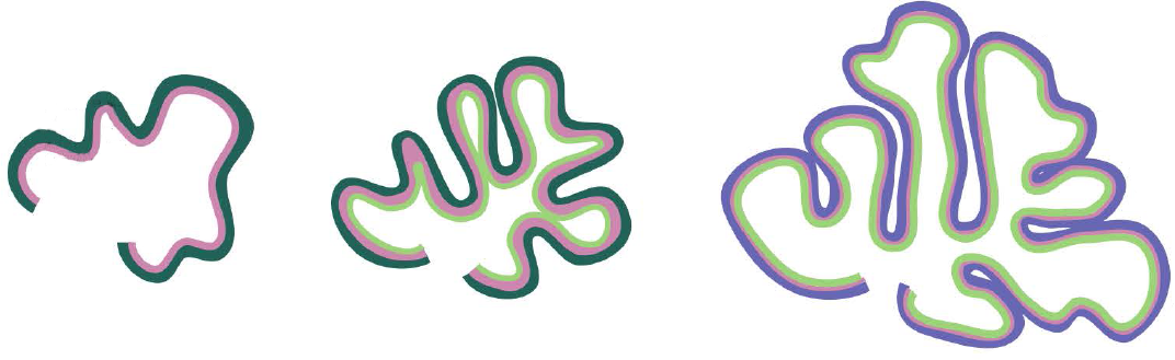 three images of the cerebellum