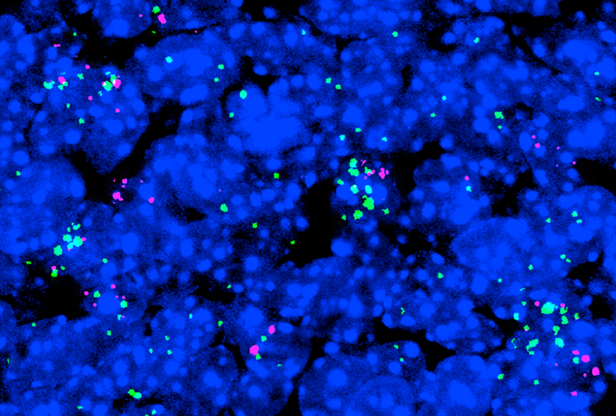 Research image of interneurons in the outer layer of a human brain.